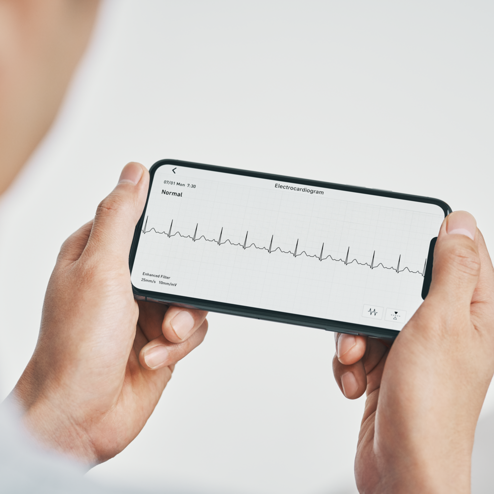 Tuotekuva: Omron® Complete™ EKG- ja olkavarsiverenpainemittari, 2-in-1 